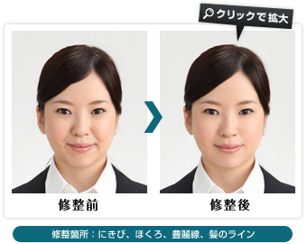 修整前、修整後　修整箇所：にきび、ほくろ、豊麗線、髪のライン